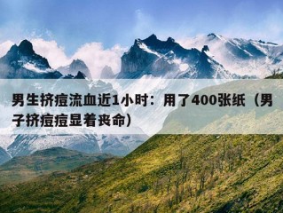 男生挤痘流血近1小时：用了400张纸（男子挤痘痘显着丧命）